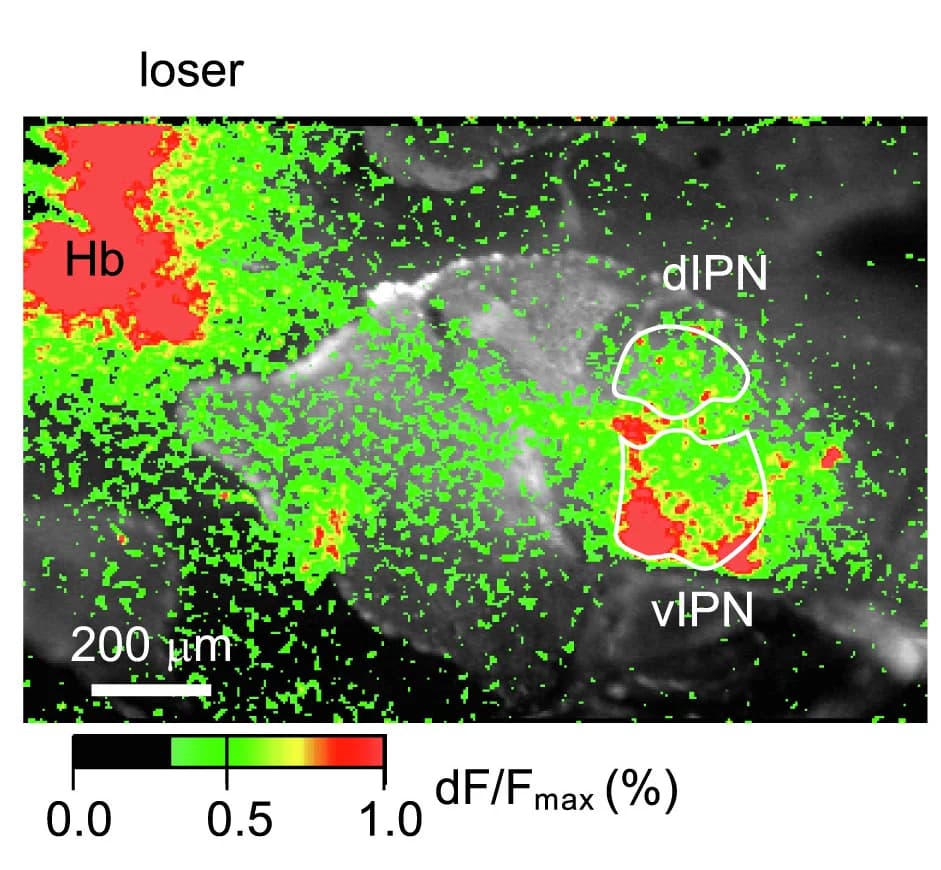 Open access visualization of Microscopy, Calcium Signaling, Loser, Brain Slice, Imaging
