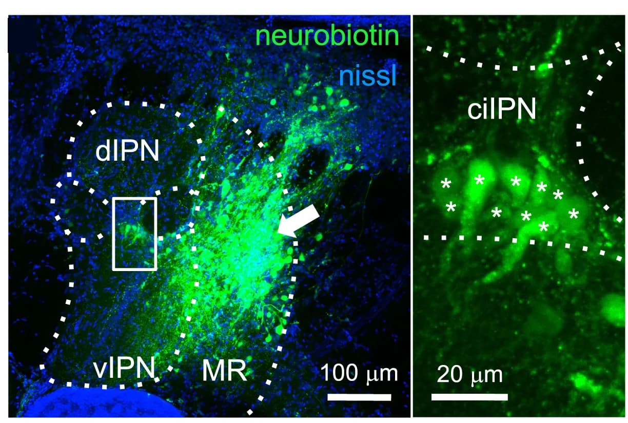 Open access visualization of Microscopy, Retrograde Labeling, MR-Projecting Neurons, Neurobiotin, ciIPN