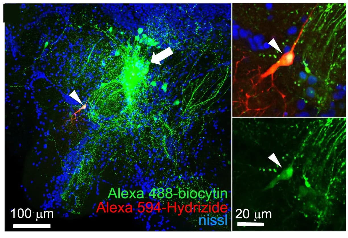 Open access visualization of Microscopy, Efferent ciIPN Neuron, Injection Site, Cell Body