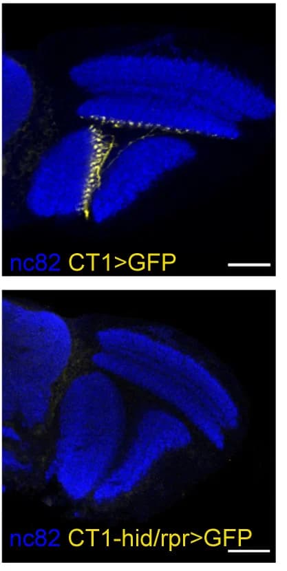 Open access visualization of Microscopy, Fluorescent Images, Neuropils, Optic Lobe, CT1-Gal4 UAS-GFP Fly