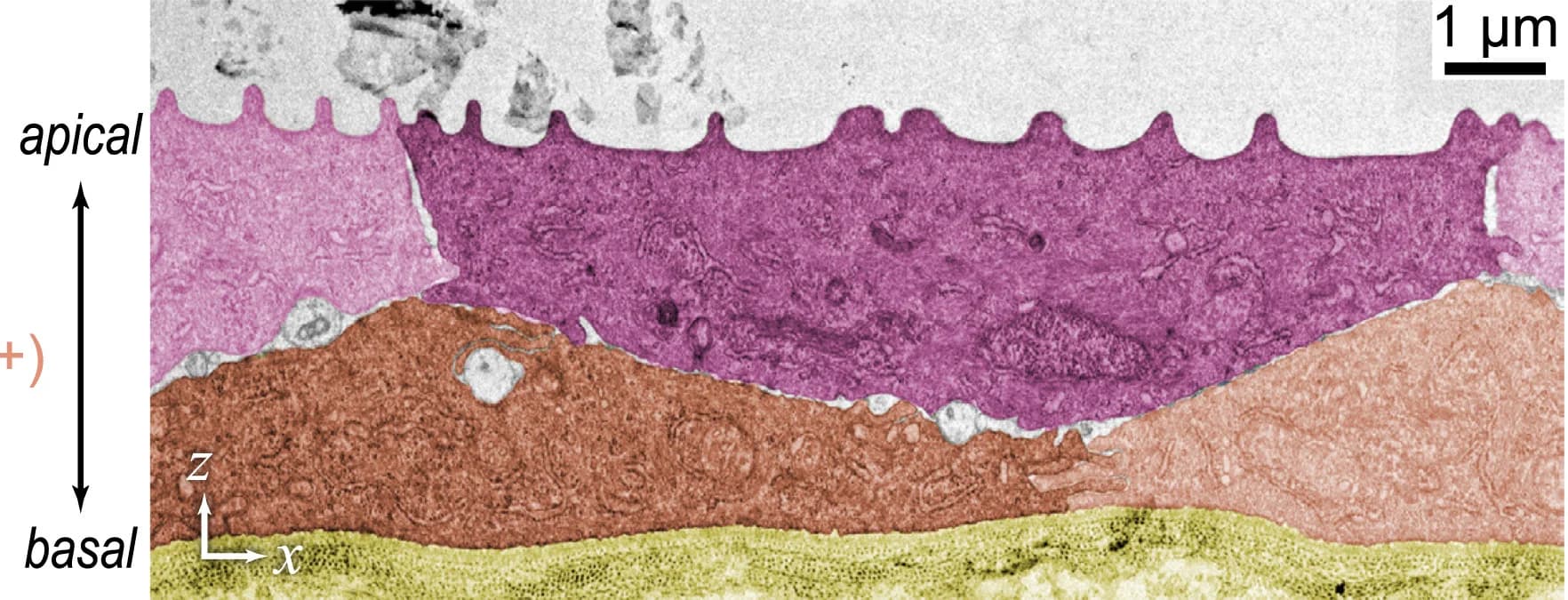 Open access visualization of Microscopy, Electron Micrograph, Epidermis, Superficial Layer, Basal Layer