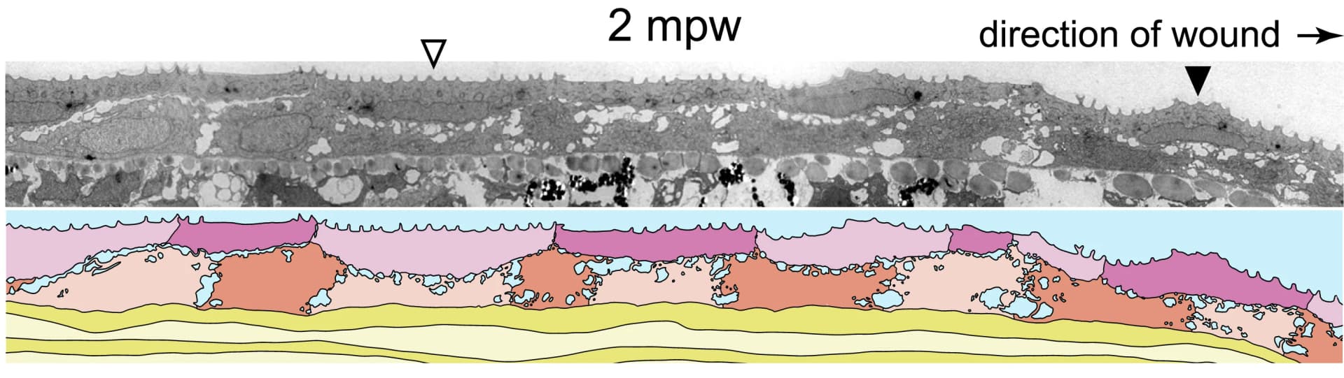 Open access visualization of Microscopy, Illustration, Electron Micrograph, Epidermis, Wounding