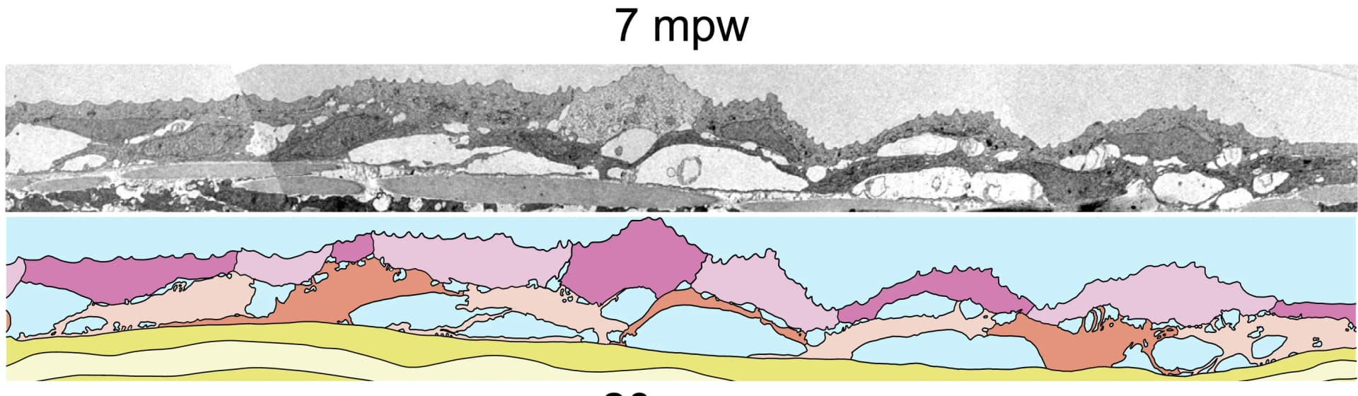Open access visualization of Microscopy, Illustration, Electron Micrograph, Epidermis, Wounding