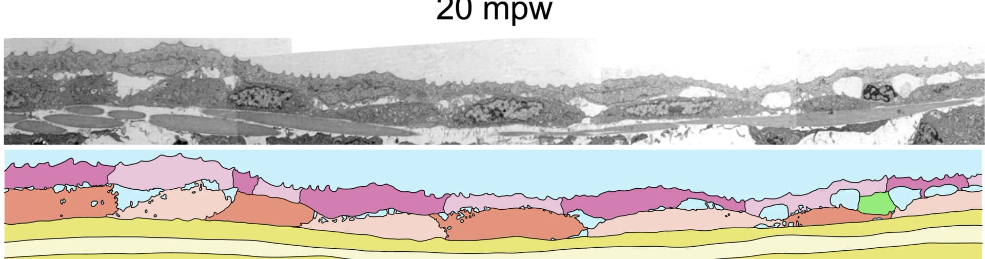 Open access visualization of Microscopy, Illustration, Electron Micrograph, Epidermis, Wounding