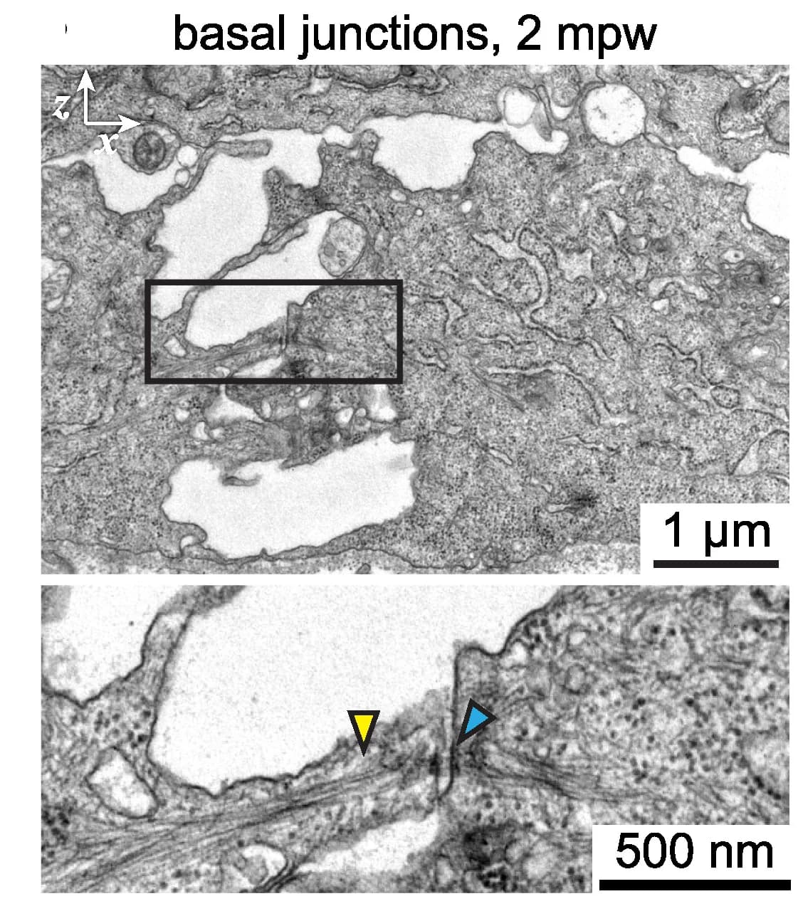 Open access visualization of Microscopy, Electron Micrograph, Cell-Cell Junction, Basal Cells, Desmosomal Plaques