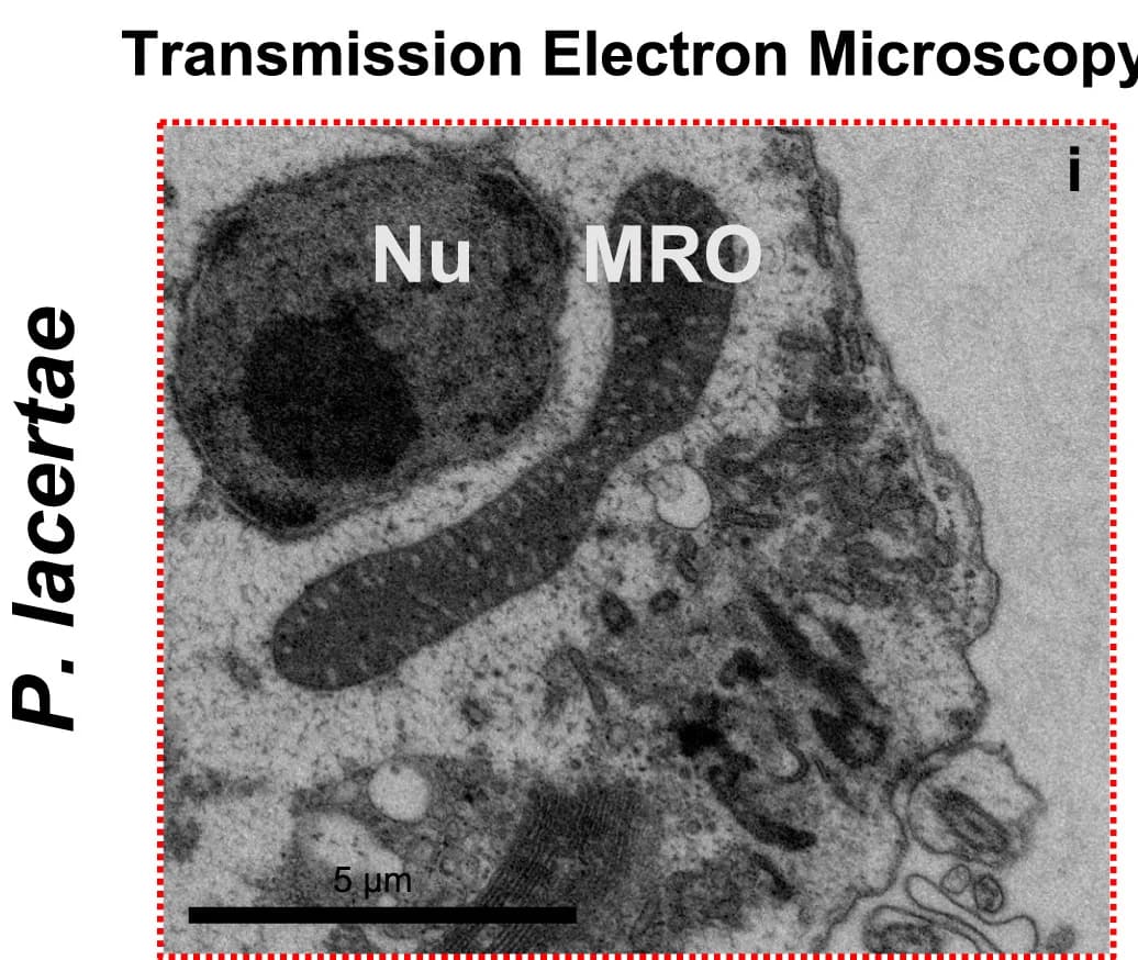 Open access visualization of Microscopy, P. lacertae, Scanning Electron Microscopy, Cell Shape, Flagella