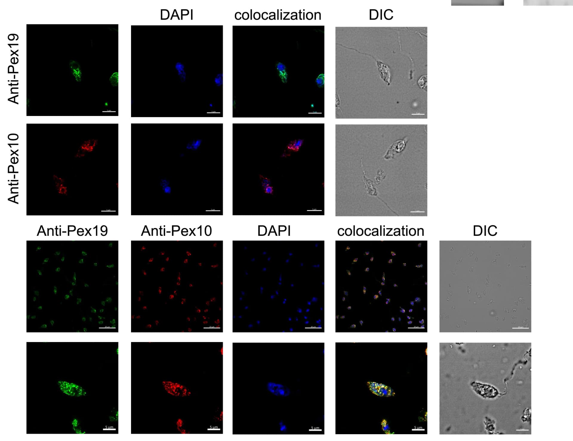 Open access visualization of Microscopy, Cellular Localization, Pex19, Pex10, P. Lacertae Cells