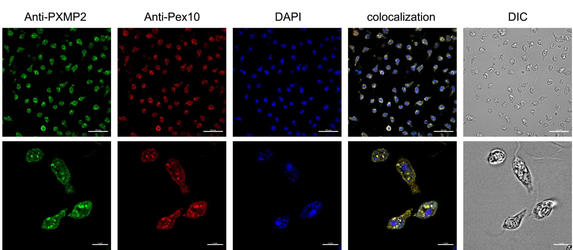 Open access visualization of Microscopy, Cellular Localization, PXMP2, Pex10, P. lacerta Cells