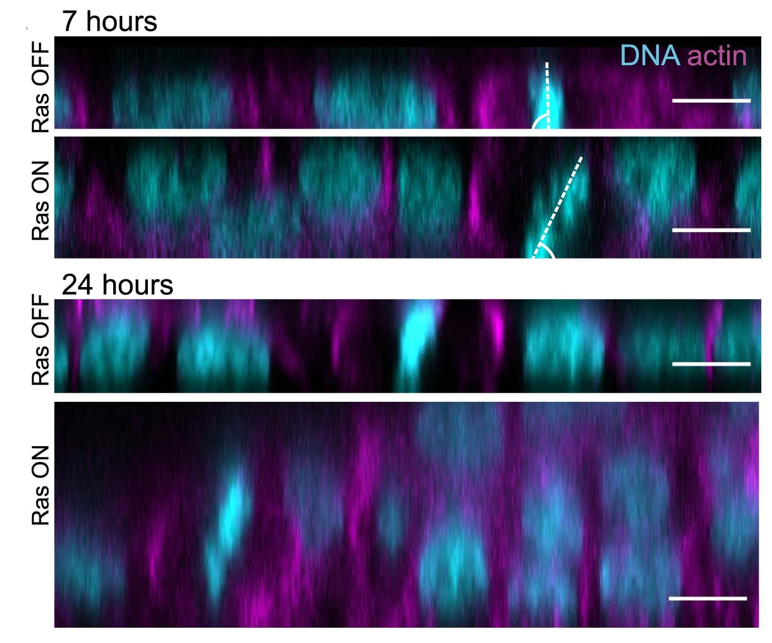 Open access visualization of Microscopy, Immunofluorescence Images, MCF10A-ER-HRasV12 Cells, Collagen, Polyacrylamide Hydrogel
