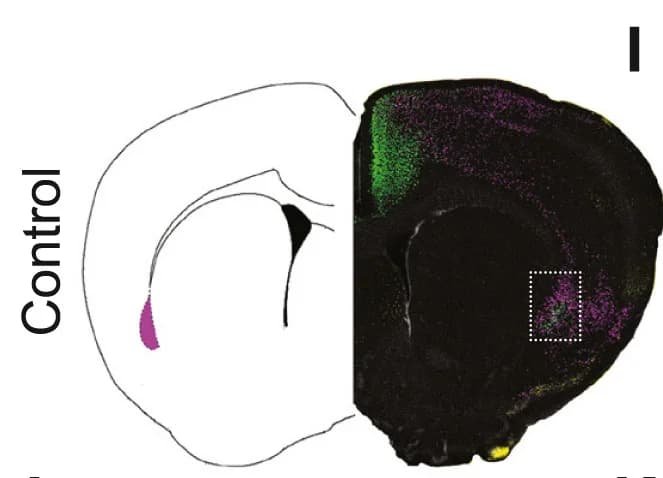 Open access visualization of Microscopy, Fos, Claustrum Neurons, OFC, ACC