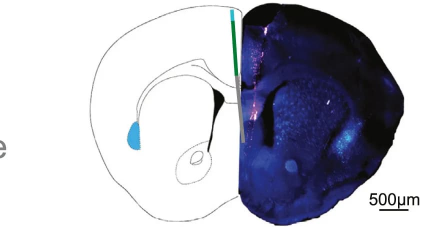 Open access visualization of Microscopy, Illustration, Viral Infection, Claustrum, Probe Tracts