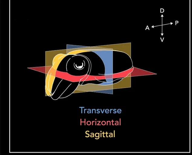 Open access visualization of Illustration, Dwarf Cuttlefish, Brain Sectioning, Transverse Plane, Horizontal Plane