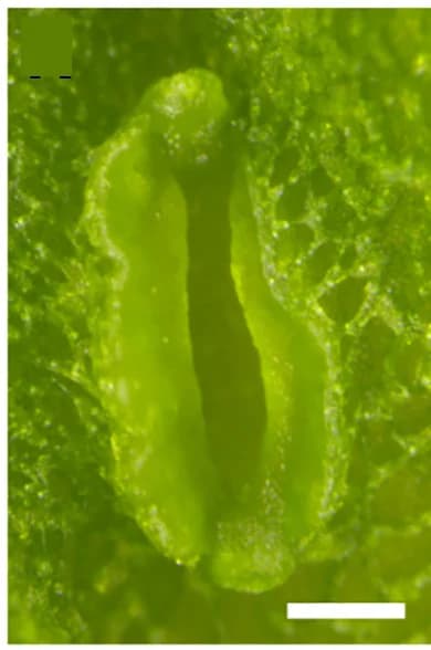 Open access visualization of Microscopy, Photo, Gemma Cup, Gemmae