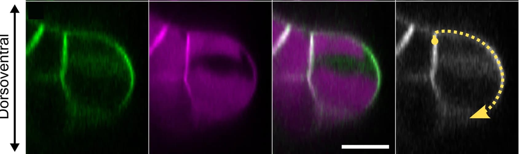 Open access visualization of Microscopy, Optical Cross Section, Venus-MpROP, Epidermal Cell, Dorsoventral Axis