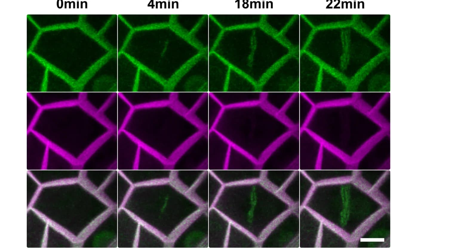 Open access visualization of Microscopy, Photo, Centrifugal Expansion, Venus-MpROP, Cell Division