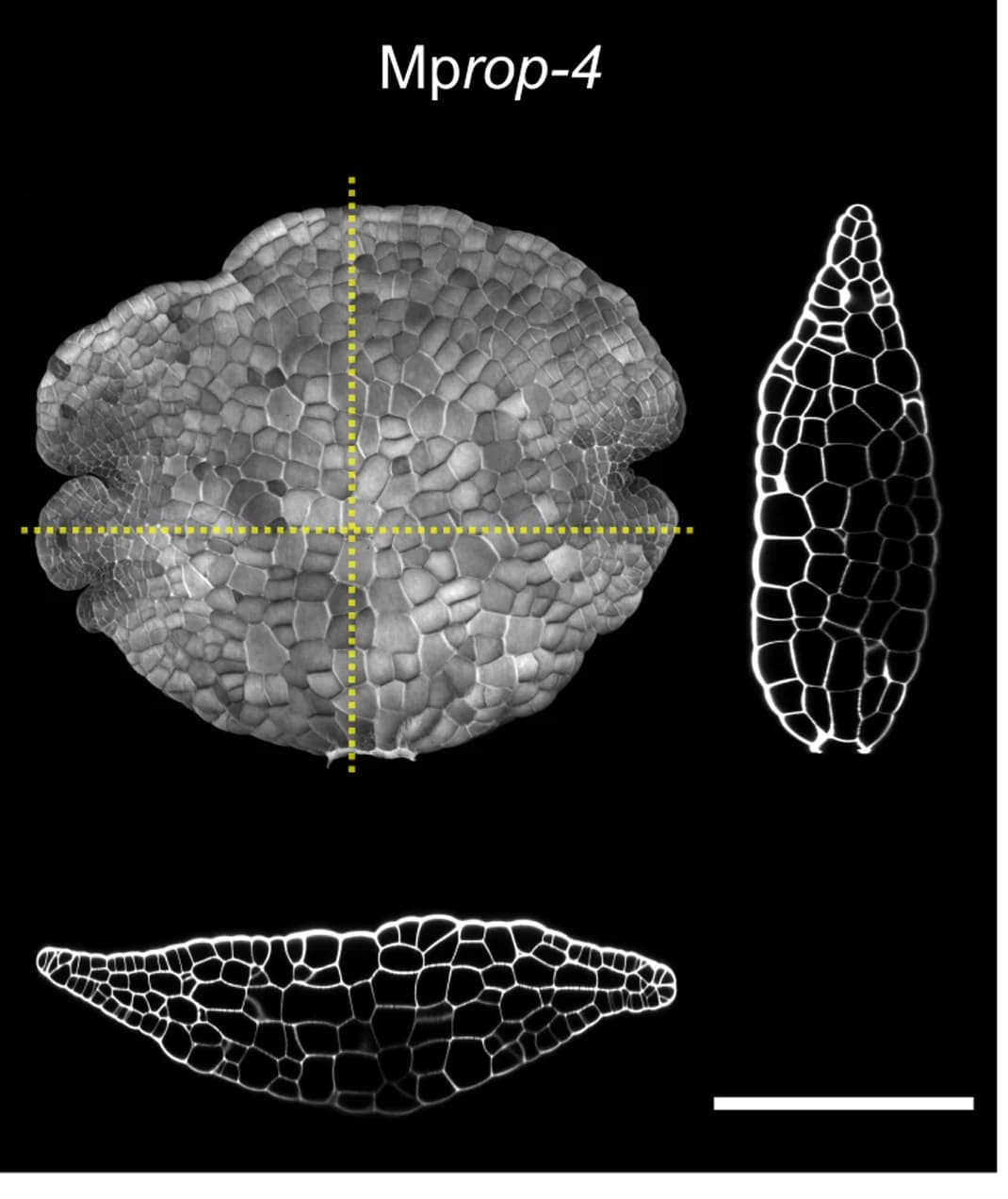 Open access visualization of Microscopy, Mprop-4 Gemmae, Cell Wall Dye SR2200, Orthogonal Cross-sections, Maximum Z Projection