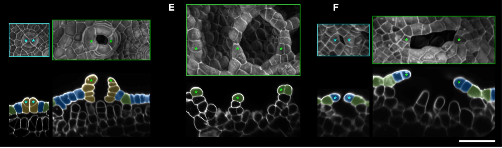 Open access visualization of Microscopy, Surface Projection, Optical Cross-Sectional Images, Air Chambers, Wild Type