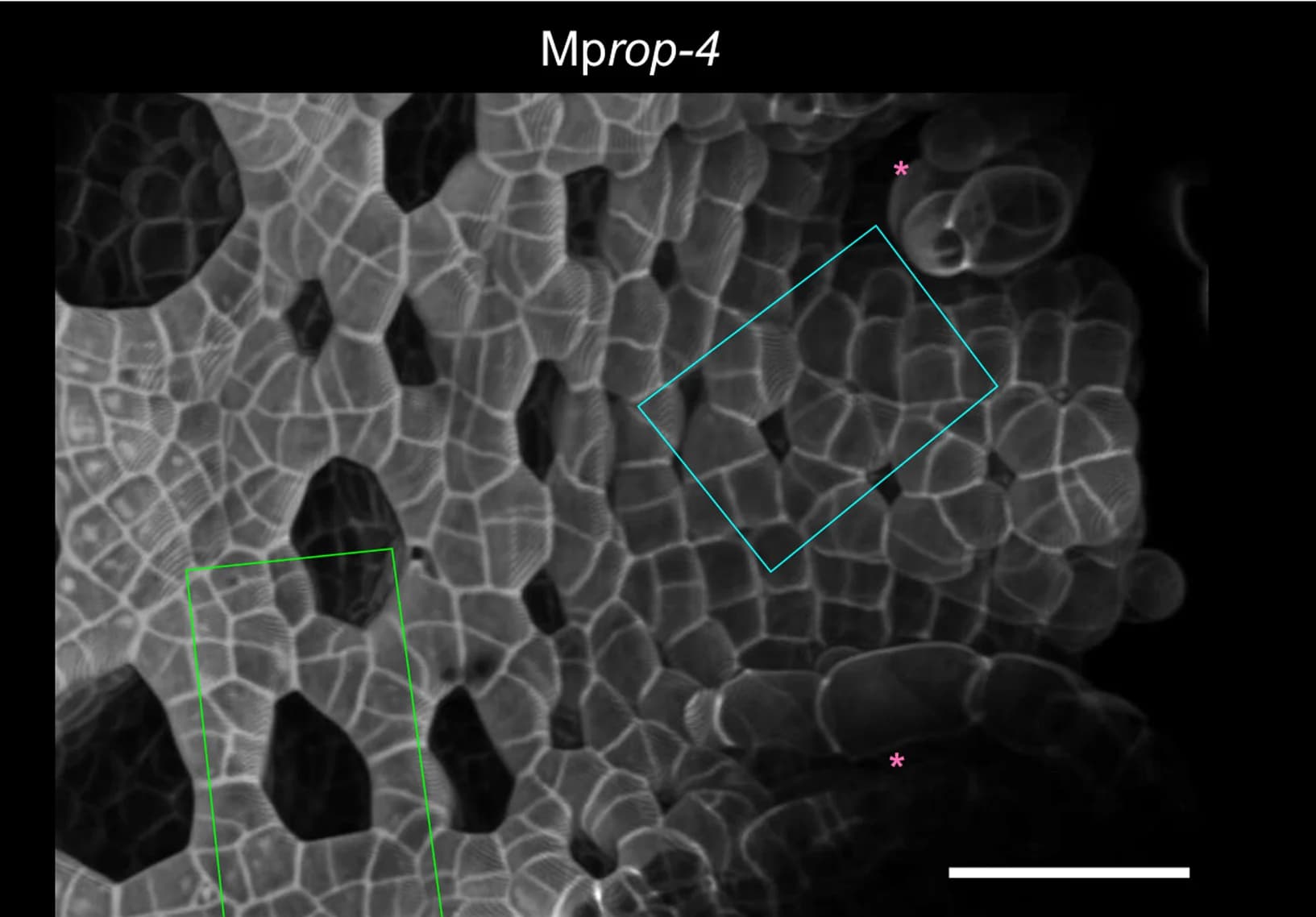 Open access visualization of Microscopy, 3D Surface Projection, Dorsal Thallus Epidermis, Meristematic Notches, Gemmalings