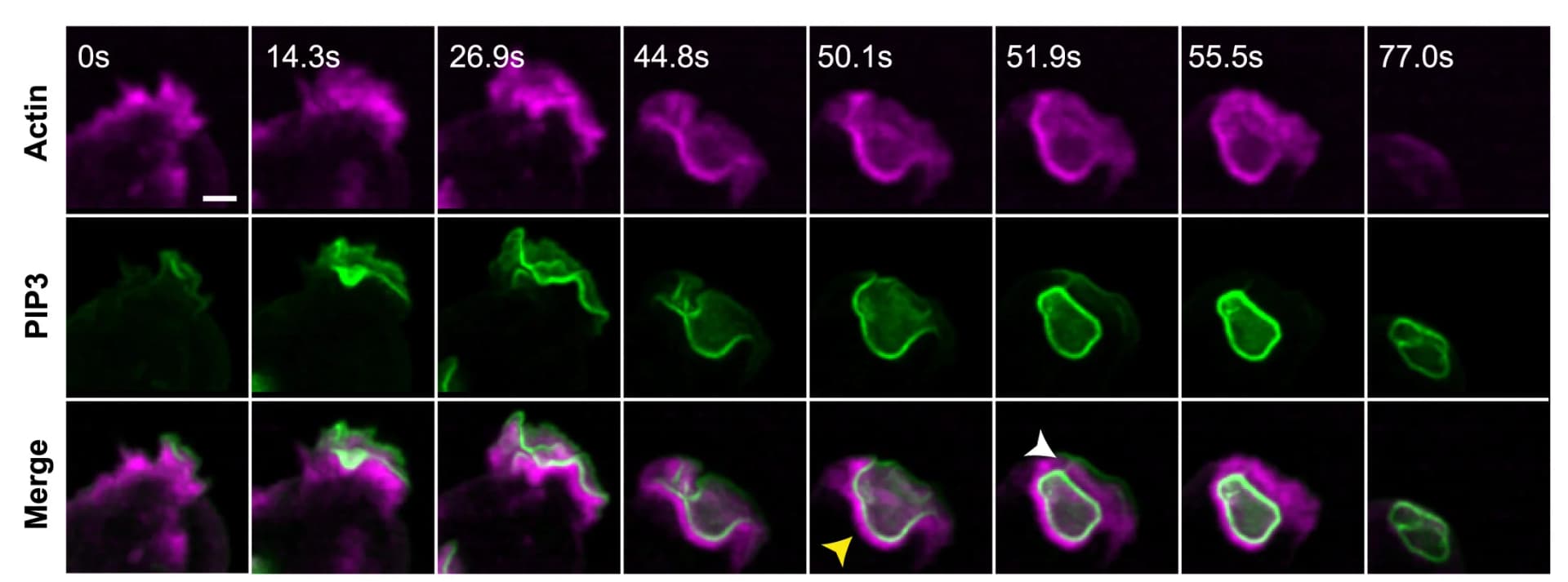 Open access visualization of Microscopy, Lip closure, Temporal resolution, F-actin scaffold, Macropinosome