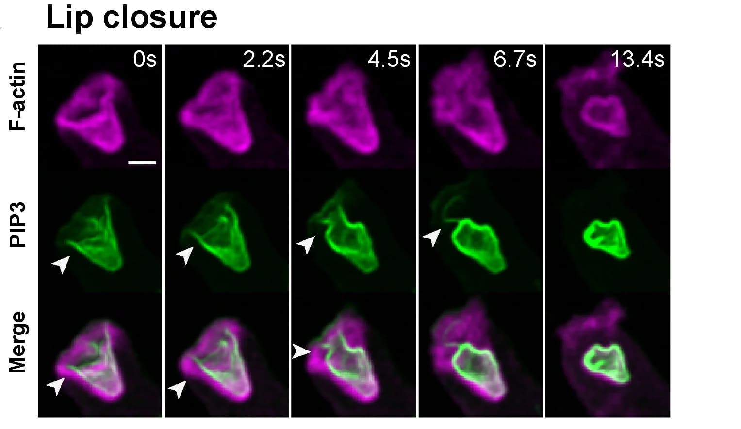 Open access visualization of Microscopy, Macropinosome, Plasma membrane, Actin cytoskeleton, Ax2 cells