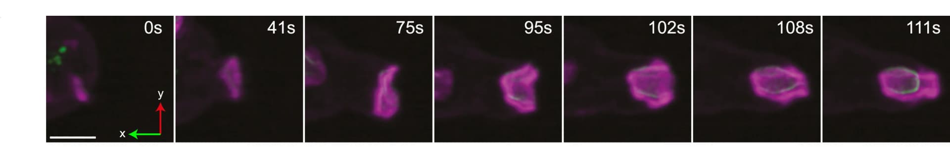 Open access visualization of Microscopy, F-actin, PIP3 domain, Macropinosome