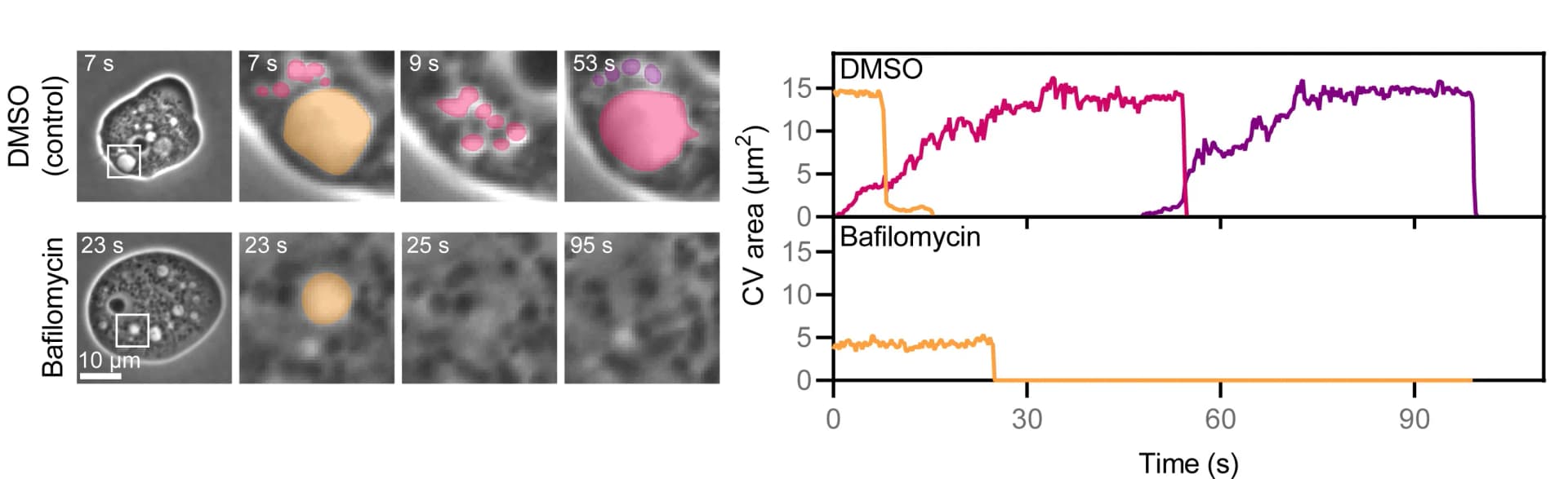 Open access visualization of Line Plot, Microscopy, Cells, Vacuolar-type H+-ATPase Inhibitor, Bafilomycin A1