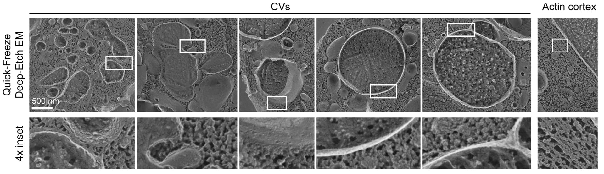 Open access visualization of Microscopy, N. gruberi cells, Contractile vacuoles, Actin cortex, Electron microscopy