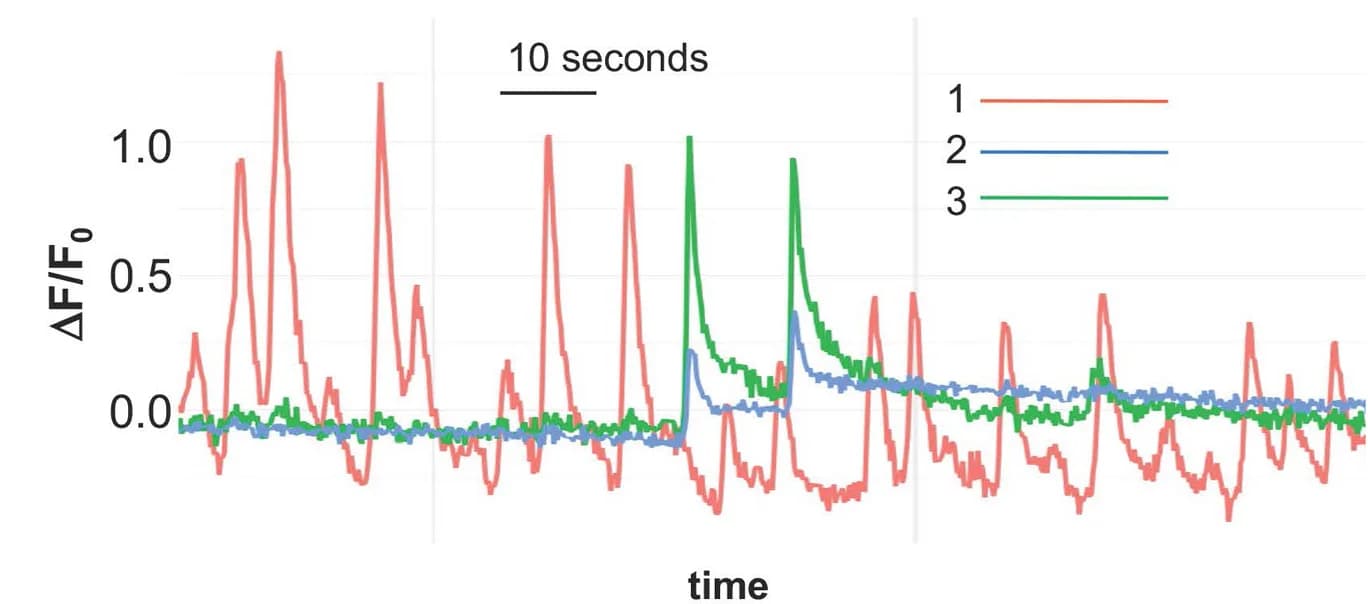 Open access visualization of Line Plot, Calcium Fluorescence, Regions of Interest, VACHT Neuron, Soma