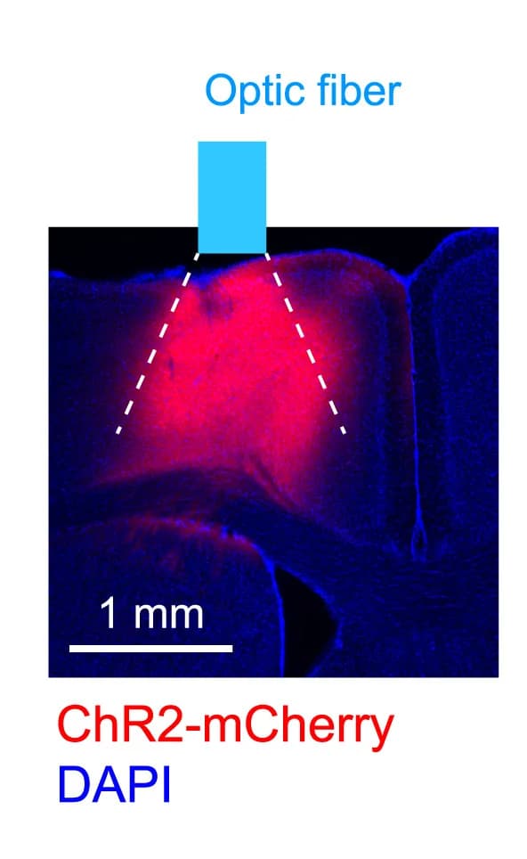 Open access visualization of Microscopy, AAV injection, Coronal section, EPI fluorescence image, Blue light