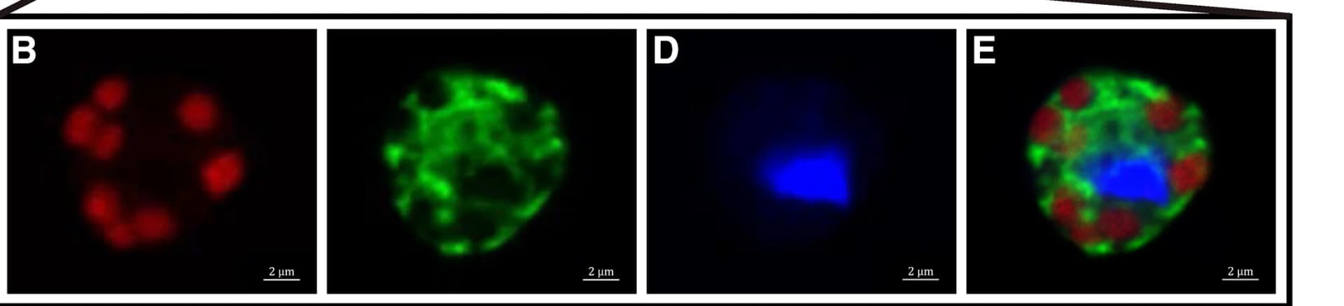 Open access visualization of Microscopy, Meringosphaera, Kleptoplasts, CARD-FISH, Confocal Microscope