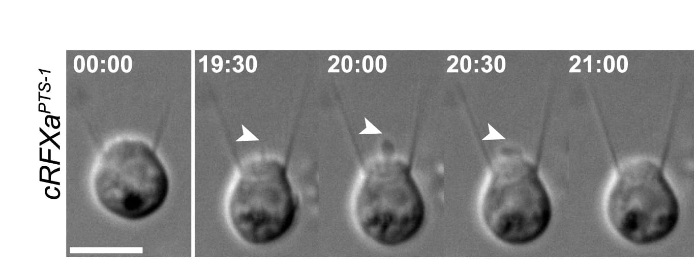 Open access visualization of Microscopy, Time Series, Ciliogenesis, Nascent Cilium, Cilia Collapse