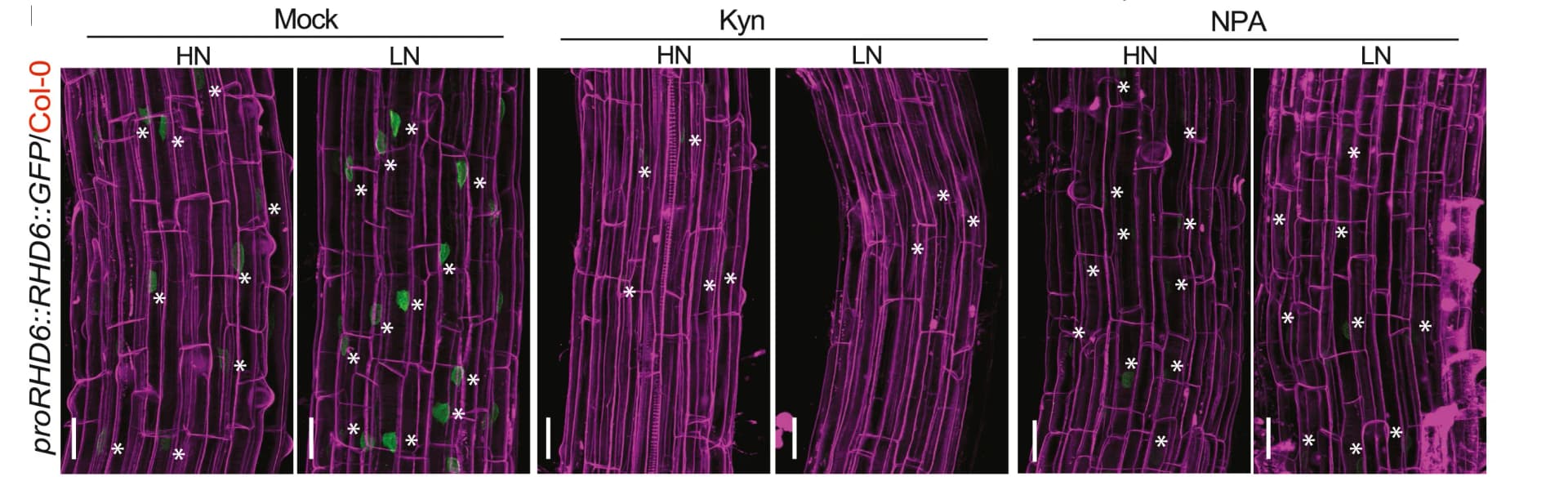 Open access visualization of Microscopy, GFP Signals, Auxin Biosynthesis Inhibitor, L-Kynurenine, Transport Inhibitor