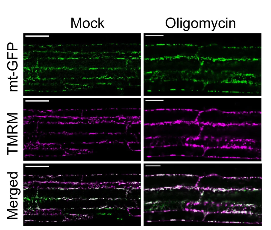 Open access visualization of Microscopy, Δψm Measurement, TMRM Dye, Root Cells, Confocal Microscope