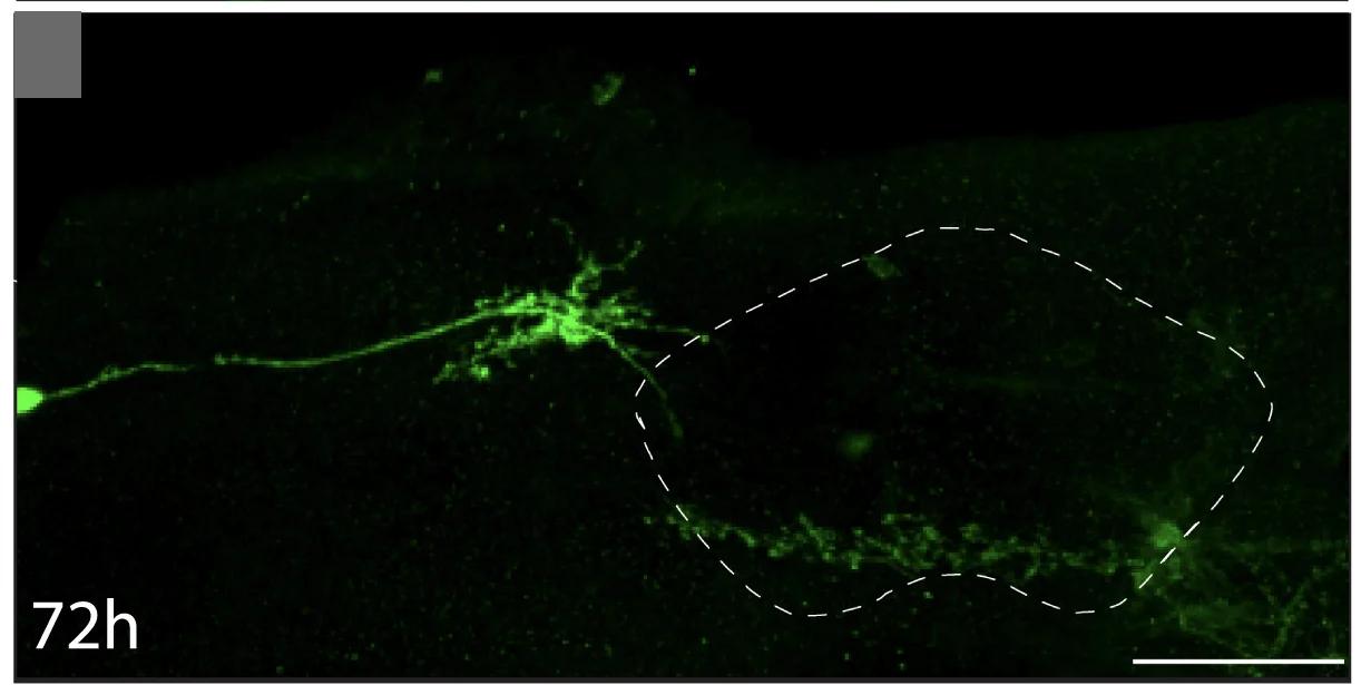 Open access visualization of Microscopy, Adult Brain, GFP, vFB Neurons