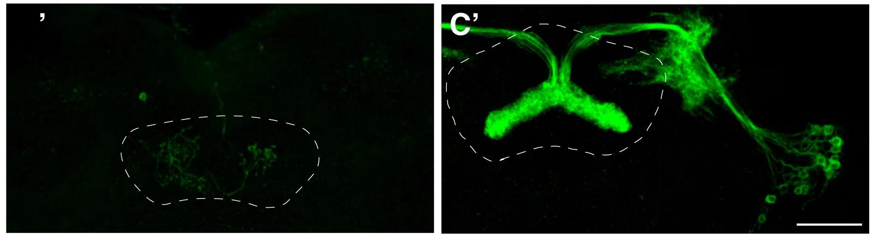 Open access visualization of Microscopy, Type II Specific Knockdown, Type II Specific Overexpression, vFB Neurons, Reporter GFP