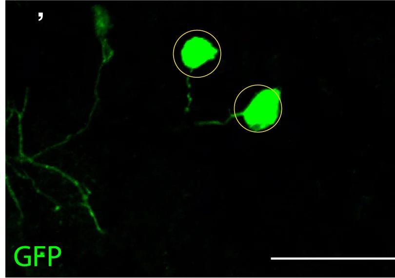 Open access visualization of Microscopy, vFB Neurons, Conditional Expression of GFP, TK-GAL4, nc82