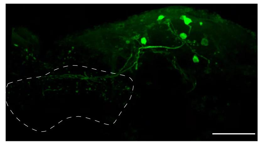 Open access visualization of Microscopy, dFB Neurons, GFP, Imp Overexpression
