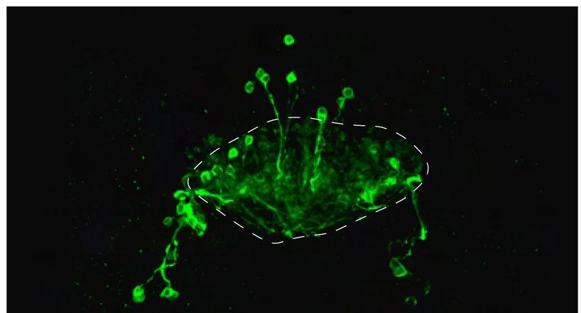 Open access visualization of Microscopy, hΔC/K Neurons, GFP, Neurites, Fat Body