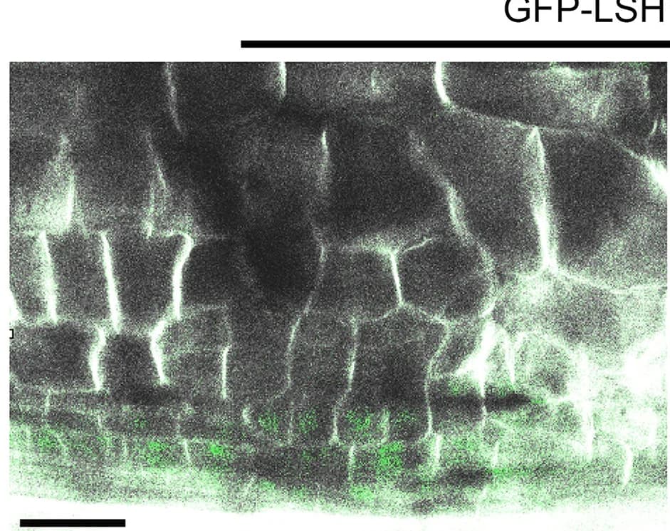 Open access visualization of Microscopy, Optical Sections, Nodule Primordia, Mature Nodules, Hairy Roots