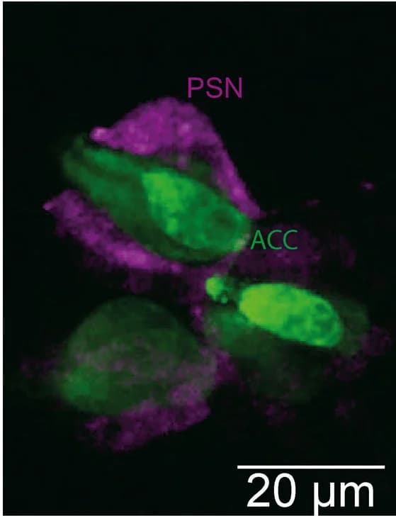 Open access visualization of Microscopy, Cii-βγ-Crystallin>GFP, Cii-pc2>mKate2, Cell Populations, Papillae