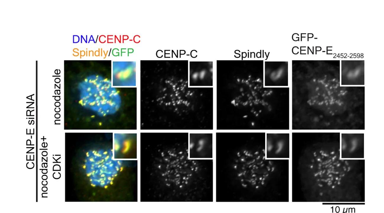 Open access visualization of Microscopy, Immunofluorescence, HeLa Cells, GFP-CENP-E, CENP-E Depletion