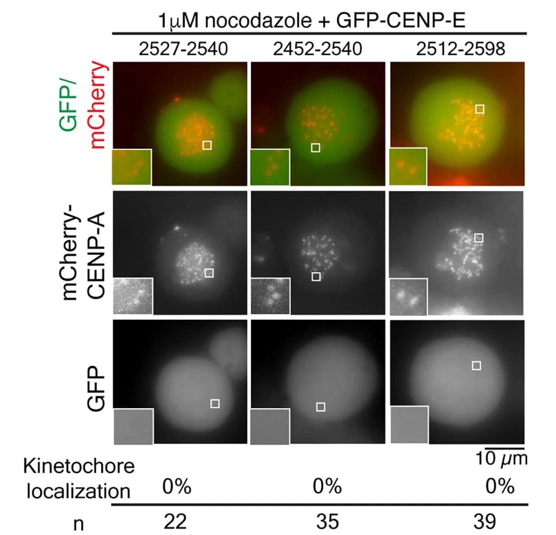 Open access visualization of Microscopy, HeLa Cells, mCherry-CENP-A, GFP-CENP-E, Domain Mutants