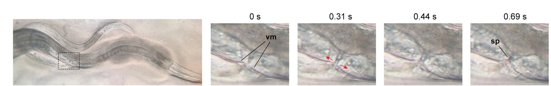 Open access visualization of Microscopy, Female Vulva, Mating, C. Nigoni, Vulval Muscles
