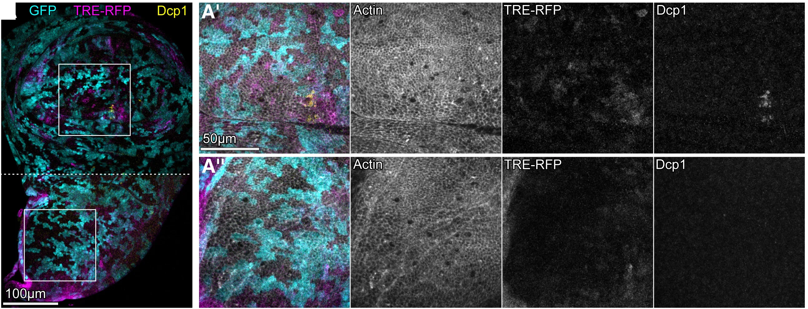 Open access visualization of Microscopy, Wing Disc, Wild-Type Clones, GFP, TRE-RFP