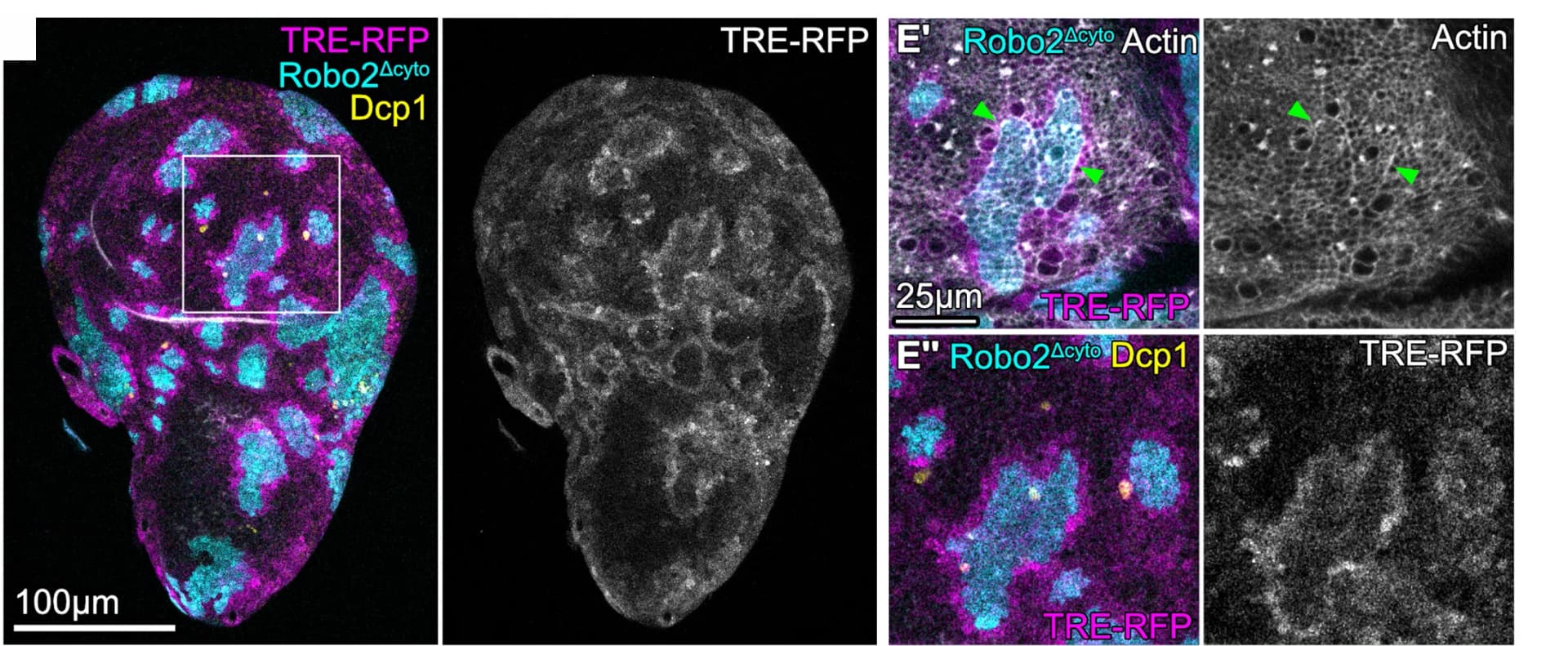 Open access visualization of Microscopy, Wing Discs, Clones, Robo2cyto, Robo2 Construct
