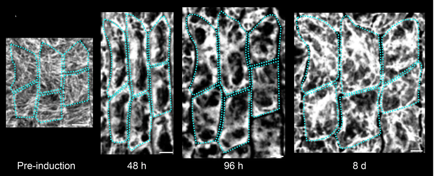 Open access visualization of Microscopy, CMT Marker, GFP-TUA6, Dexamethasone Treatment, Exocarp Cells