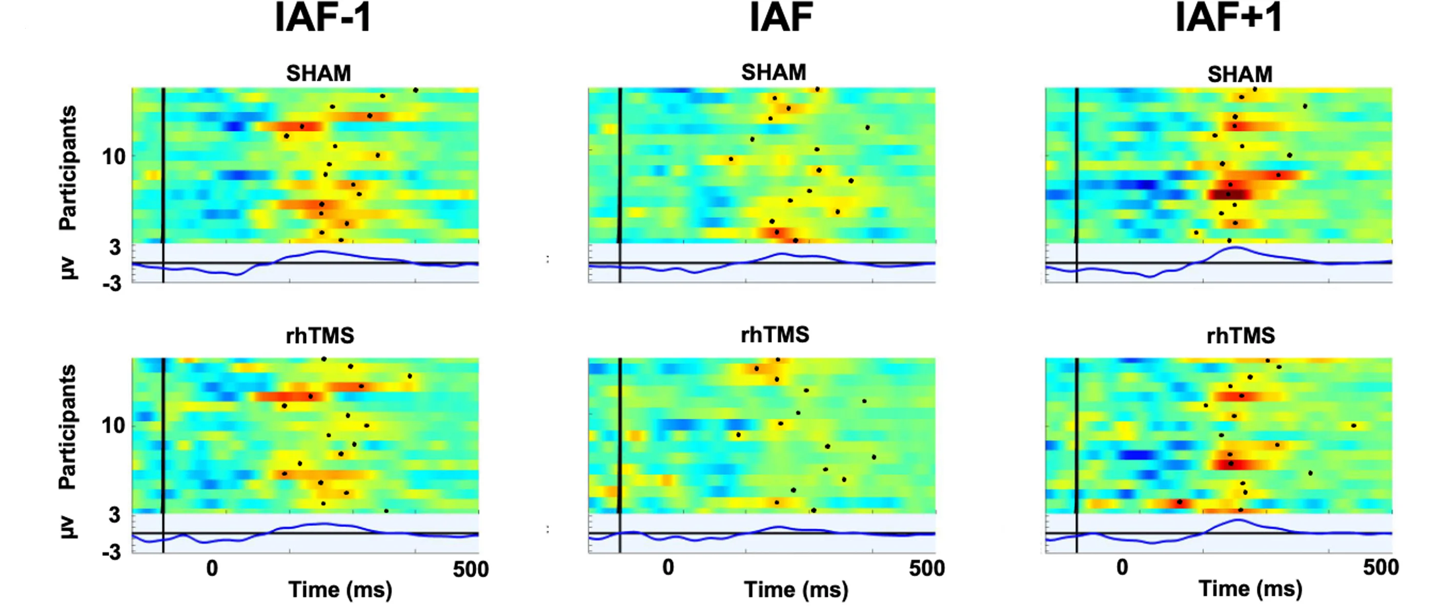 Open access visualization of Heatmap, Line Plot, ERP Image, Electrode Cz, SHAM