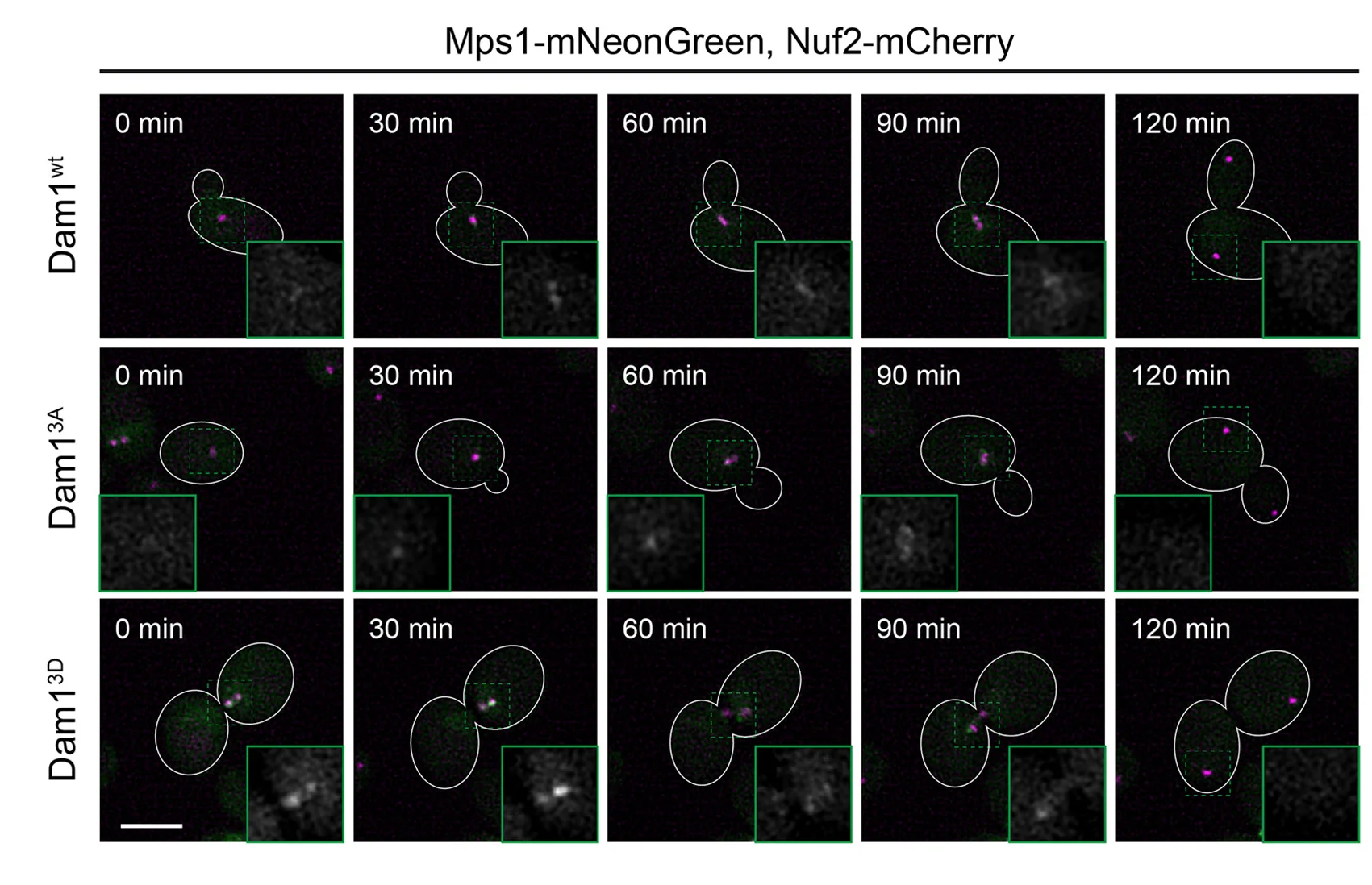 Open access visualization of Microscopy, Micrographs, Time-Lapse Microscopy, Mps1-mNeonGreen, Nuf2-mCherry