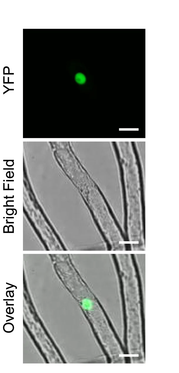 Open access visualization of Microscopy, Rhizoids, Calcium Reporter, YFP Channel