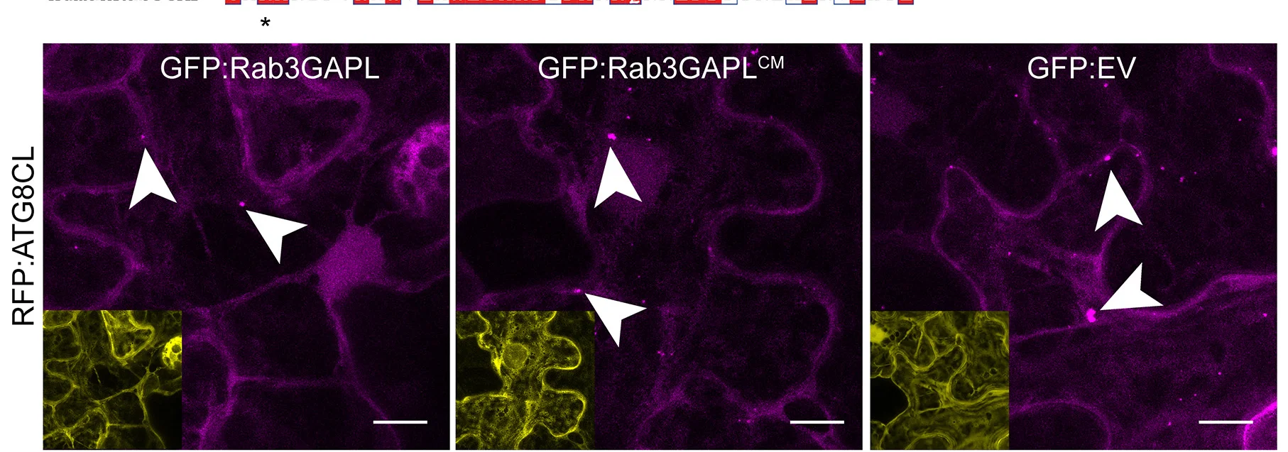 Open access visualization of Microscopy, Confocal Micrographs, Leaf Epidermal Cells, RFP:ATG8CL, GFP:Rab3GAPL